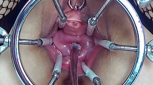 Brutal German BDSM, inner Pussy Cervix and Tits